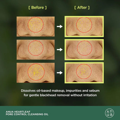 [Anua] Heartleaf Pore Control Cleansing Oil 200ml